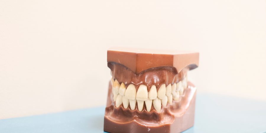 Dantų protezavimas – paneikime mitus!